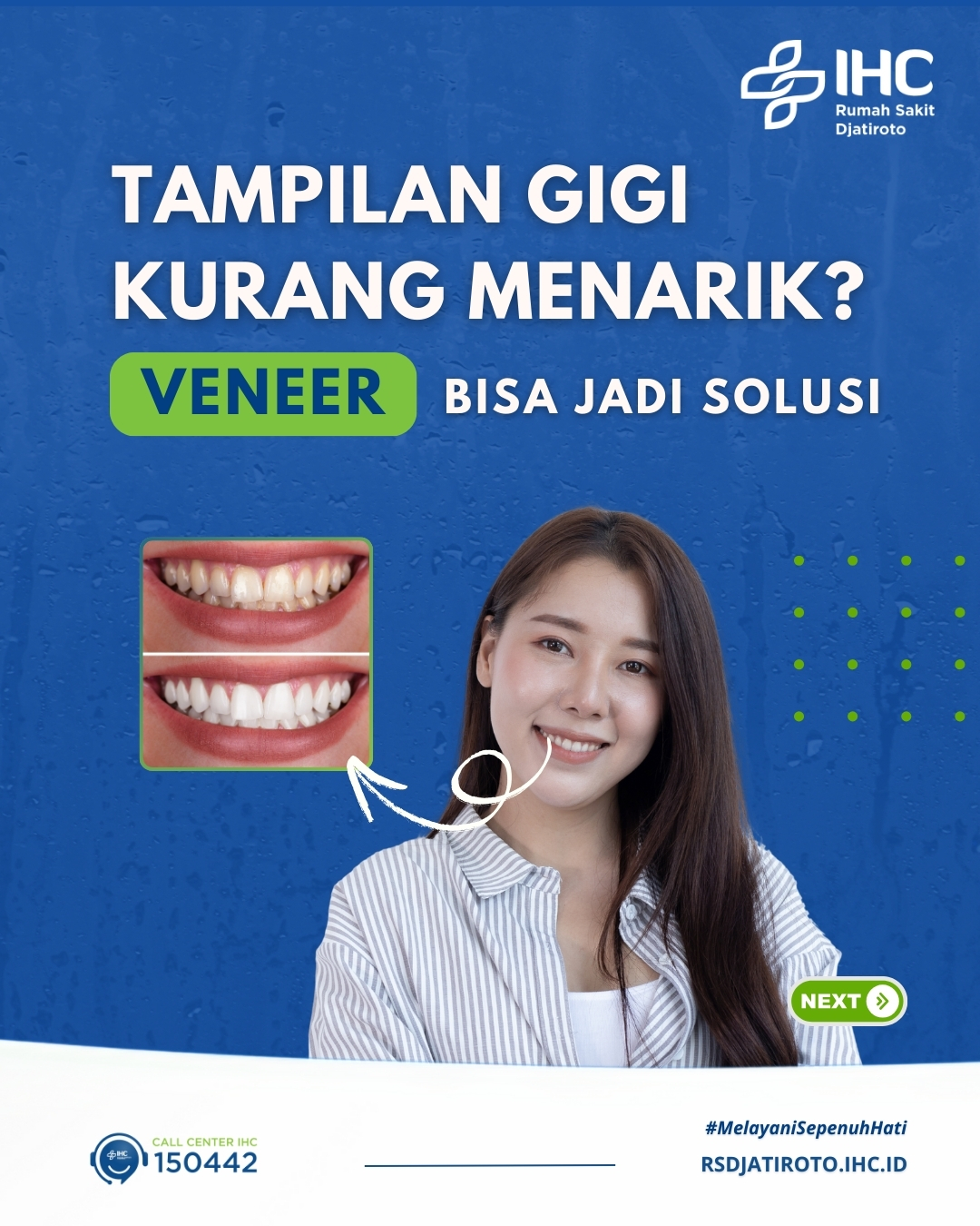 Tampilan Gigi Kurang Menarik? Veneer Bisa Jadi Solusi